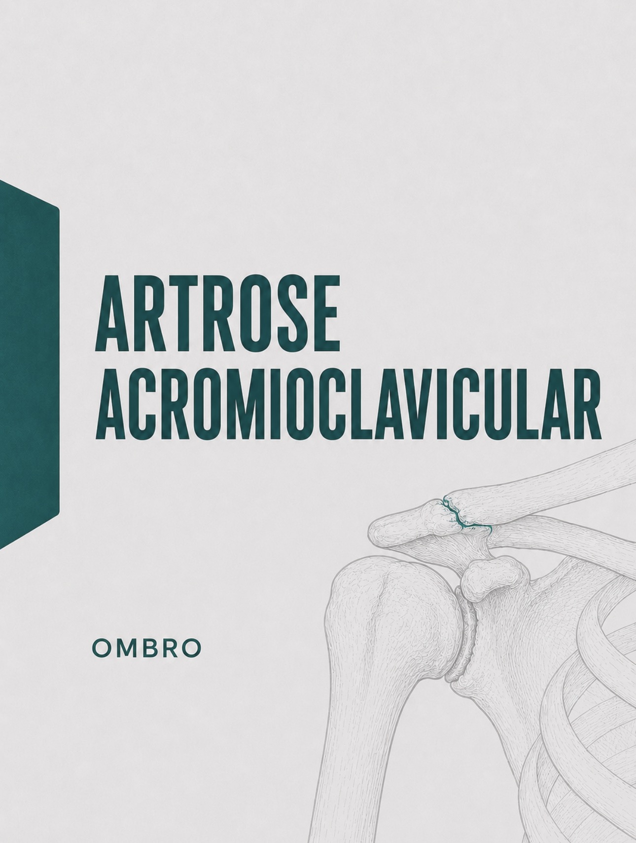 Ilustração médica de artrose e alterações degenerativas na articulação acromioclavicular