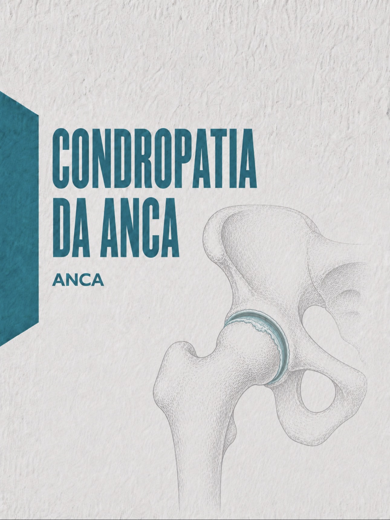 Ilustração médica da superfície cartilagínea acetabular e femoral na anca