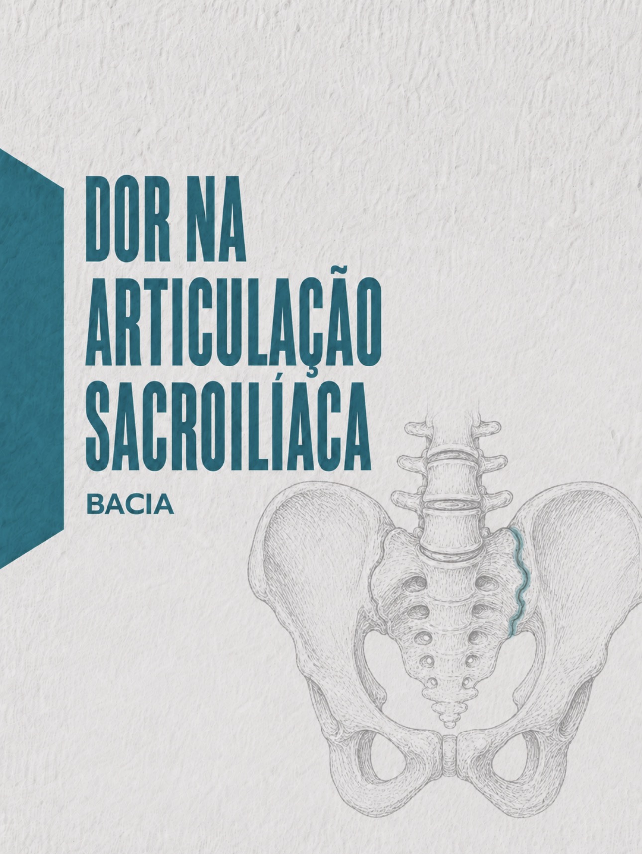 Ilustração médica da articulação sacroilíaca e ligamentos associados