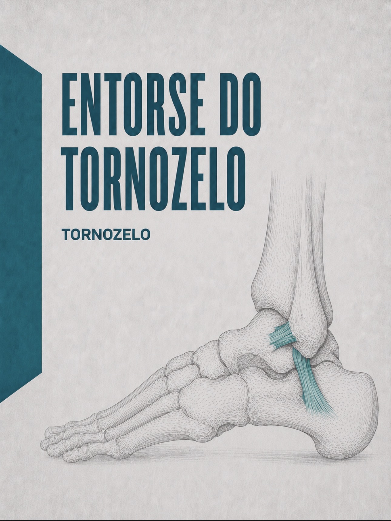 Ilustração médica dos ligamentos laterais do tornozelo (talofibular anterior e calcaneofibular)