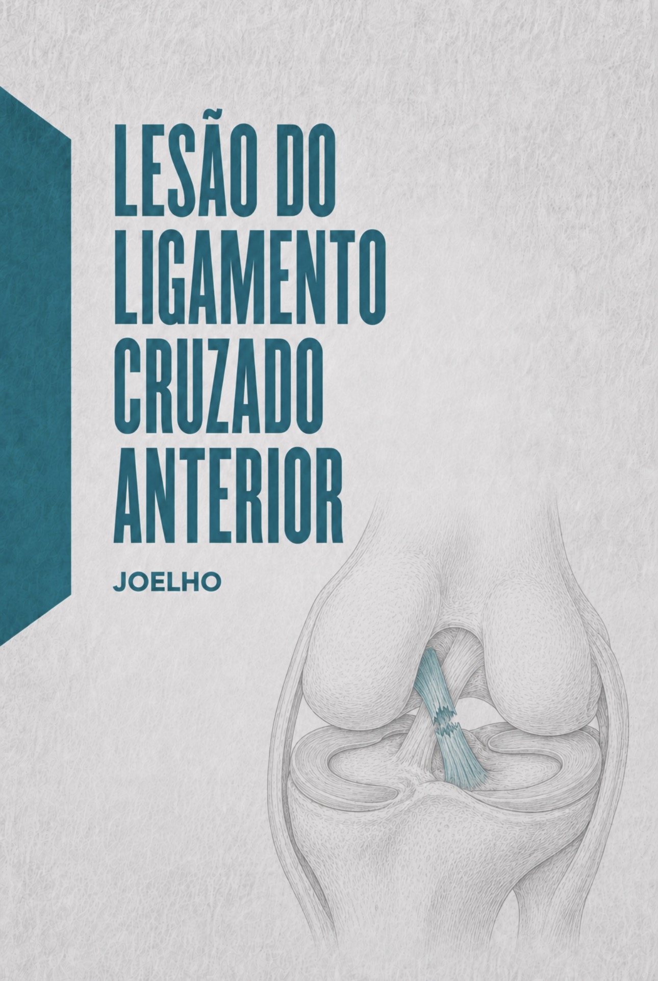 Ilustração médica do ligamento cruzado anterior na fossa intercondiliana do joelho