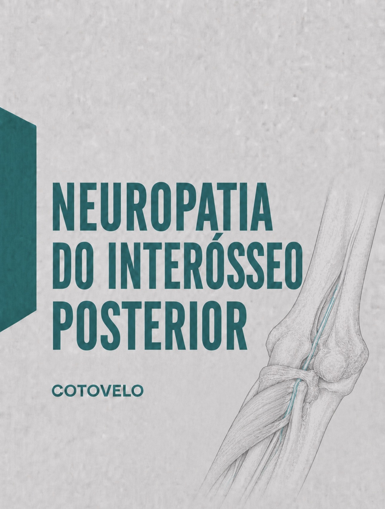 Ilustração médica do ramo interósseo posterior do nervo radial na arcada de Frohse