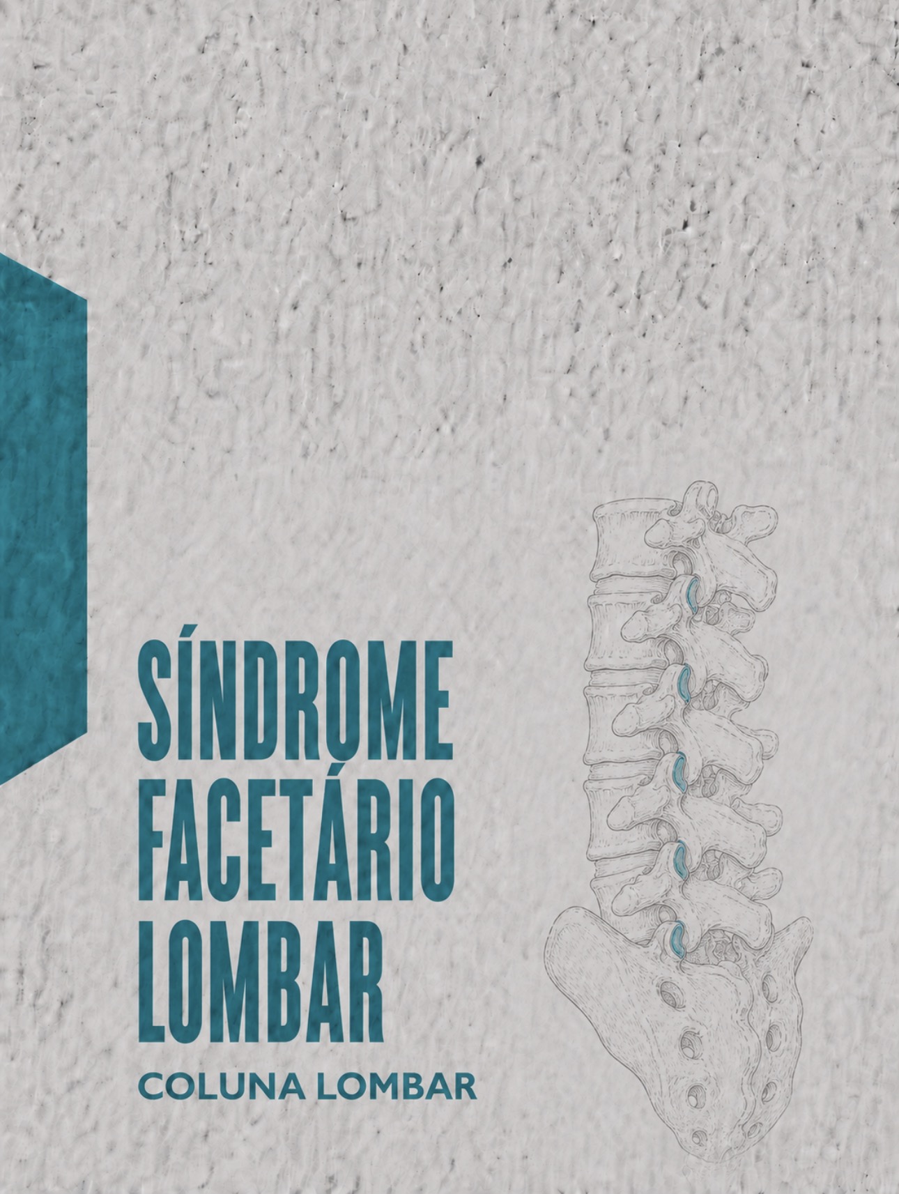 Ilustração médica das articulações zigapofisárias (facetas) e inervação pelo ramo medial