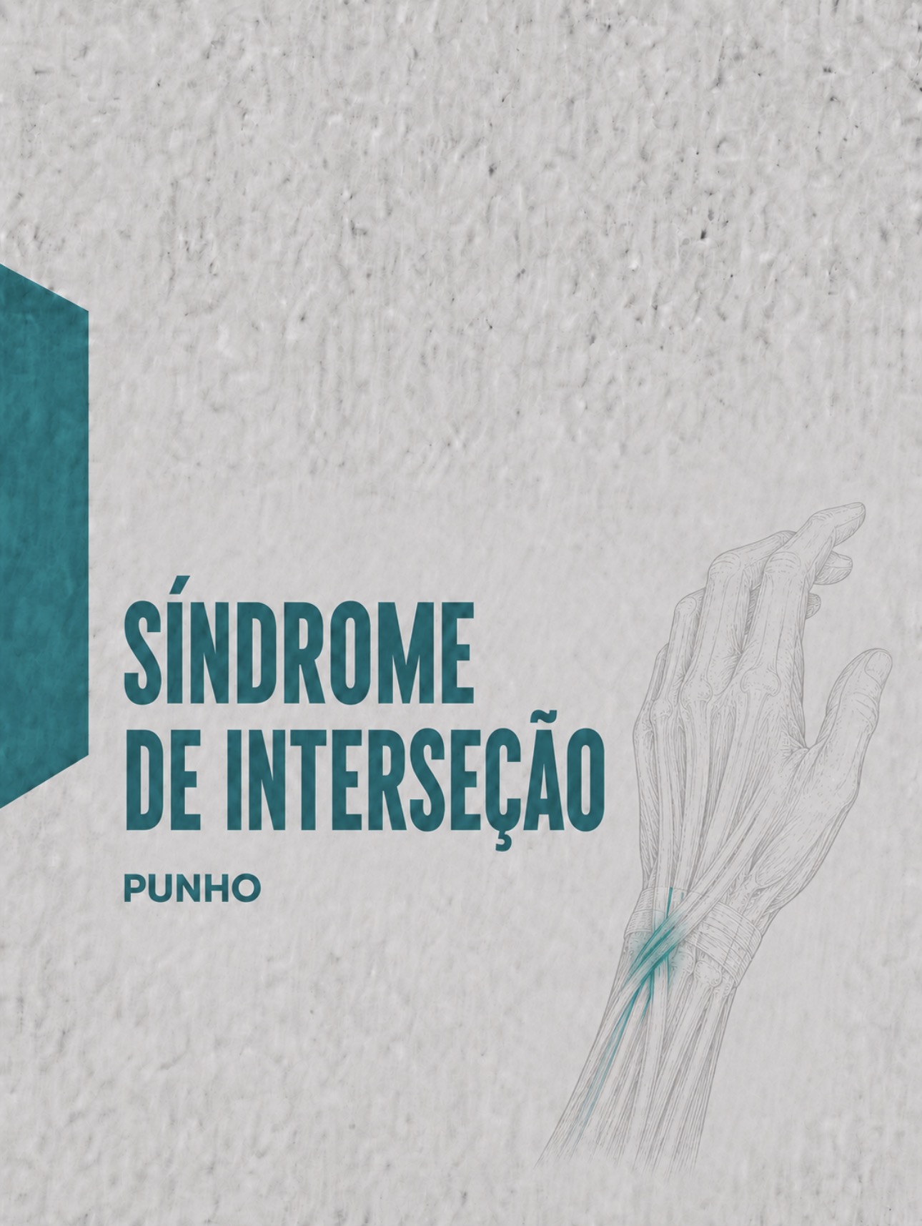 Ilustração médica do cruzamento tendinoso no dorso do antebraço na síndrome de interseção