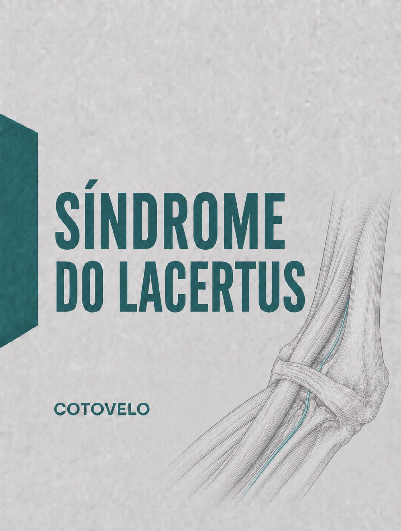 Ilustração médica do lacertus fibrosus e compressão proximal do nervo mediano no cotovelo
