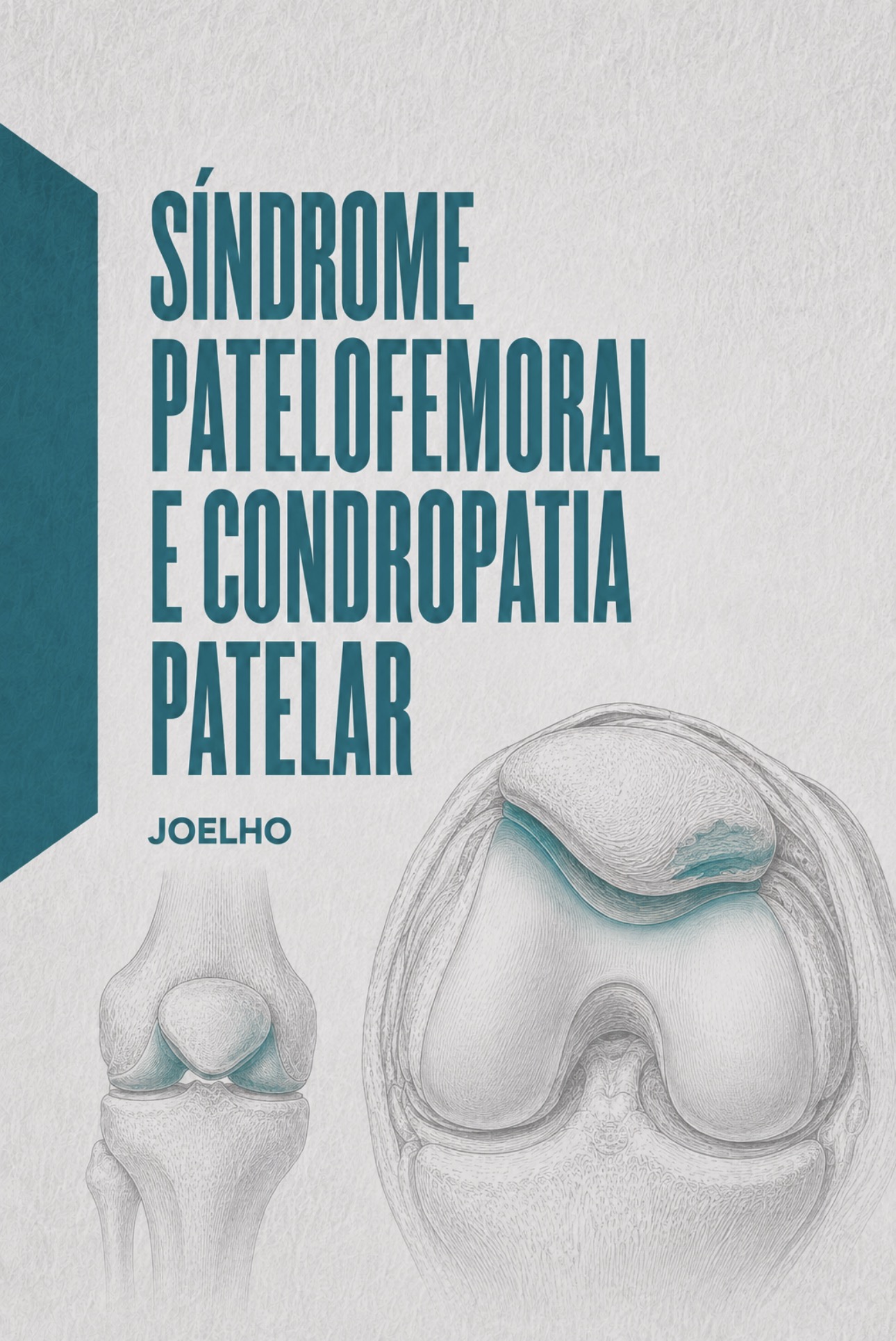 Ilustração médica da articulação patelofemoral e alinhamento da rótula na tróclea