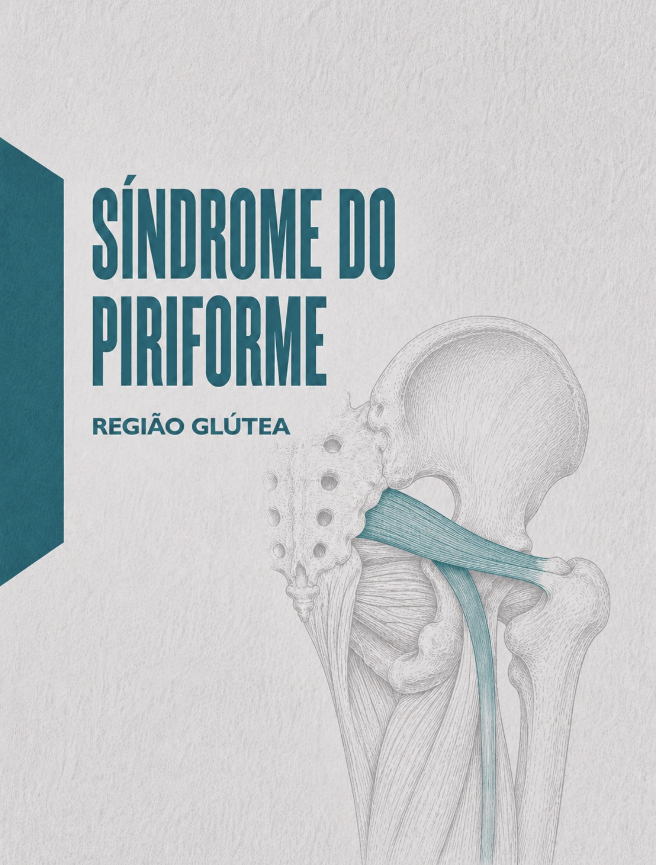 Ilustração médica do músculo piriforme e sua relação anatómica com o nervo ciático