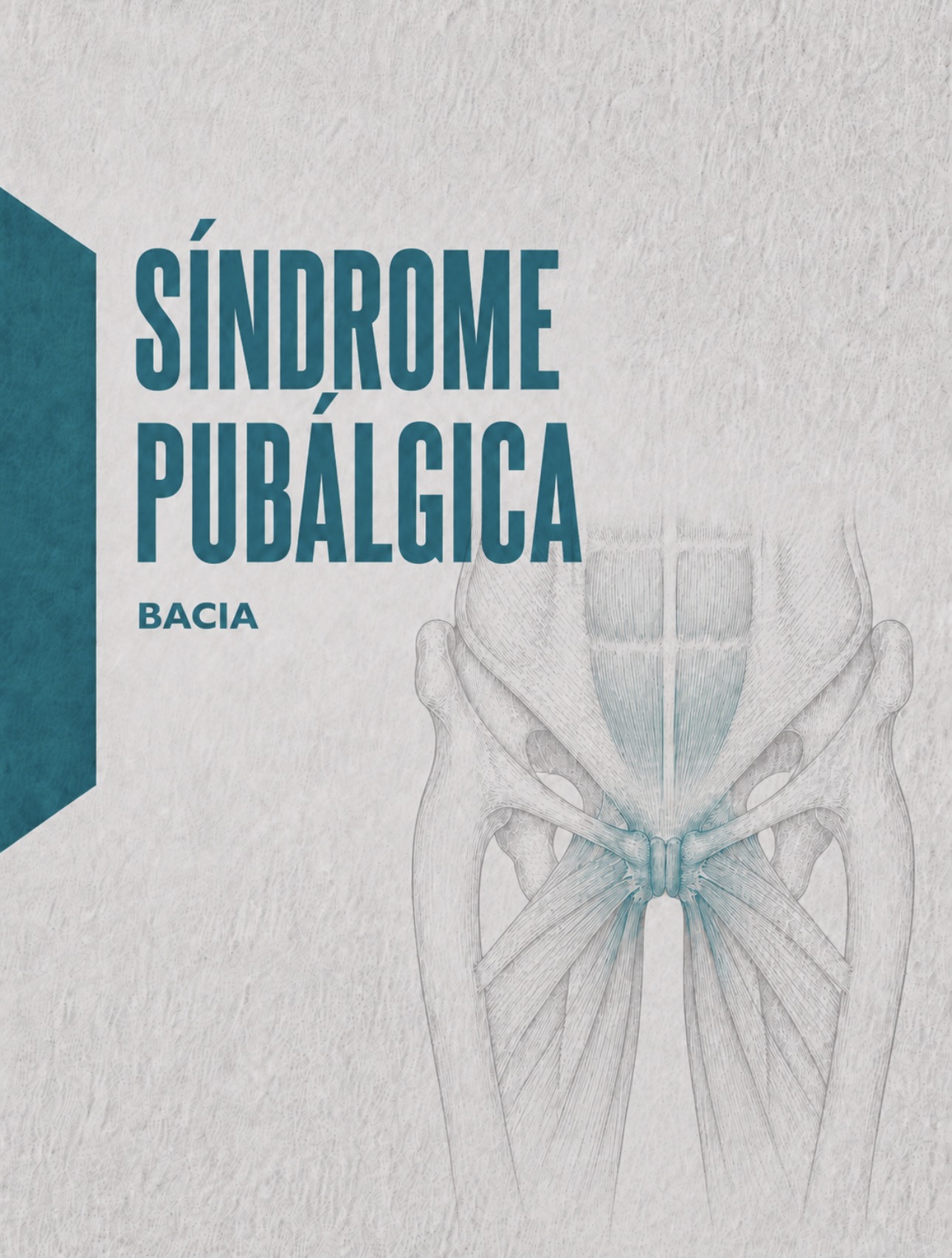 Ilustração médica da sínfise púbica, adutores e aponevrose do reto abdominal na pubalgia