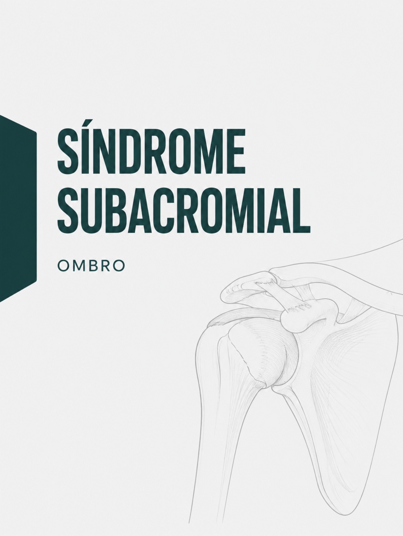 Ilustração médica da síndrome de conflito subacromial e espaço subacromial do ombro