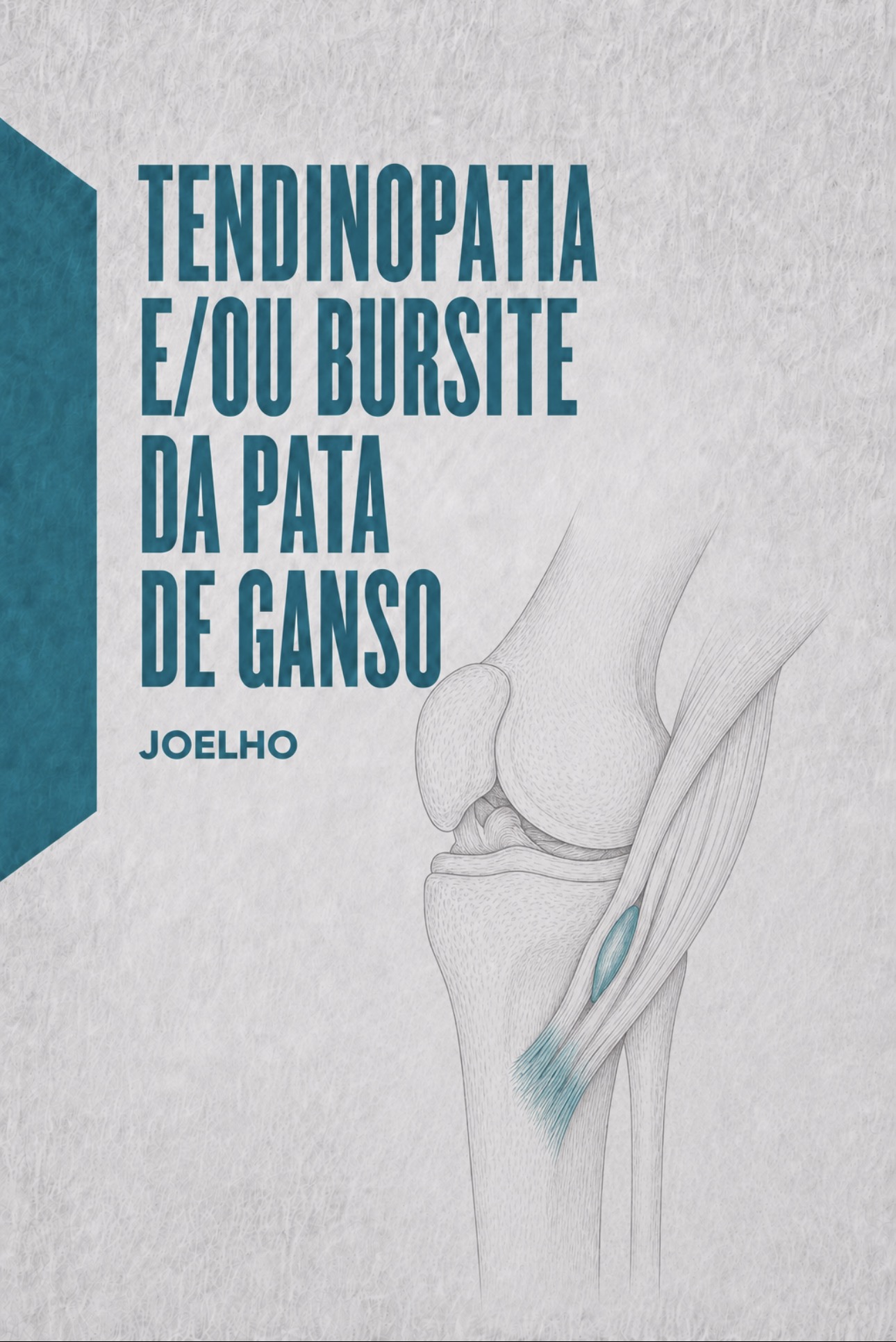 Ilustração médica da inserção tendinosa e bursa anserina (pata de ganso) na tíbia proximal