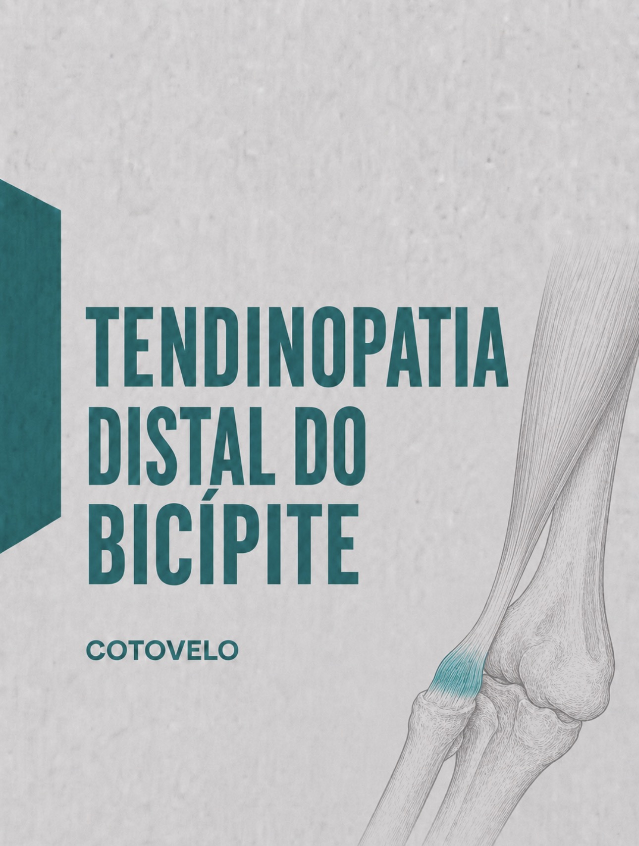 Ilustração médica do tendão distal do bicípite na tuberosidade bicipital do rádio