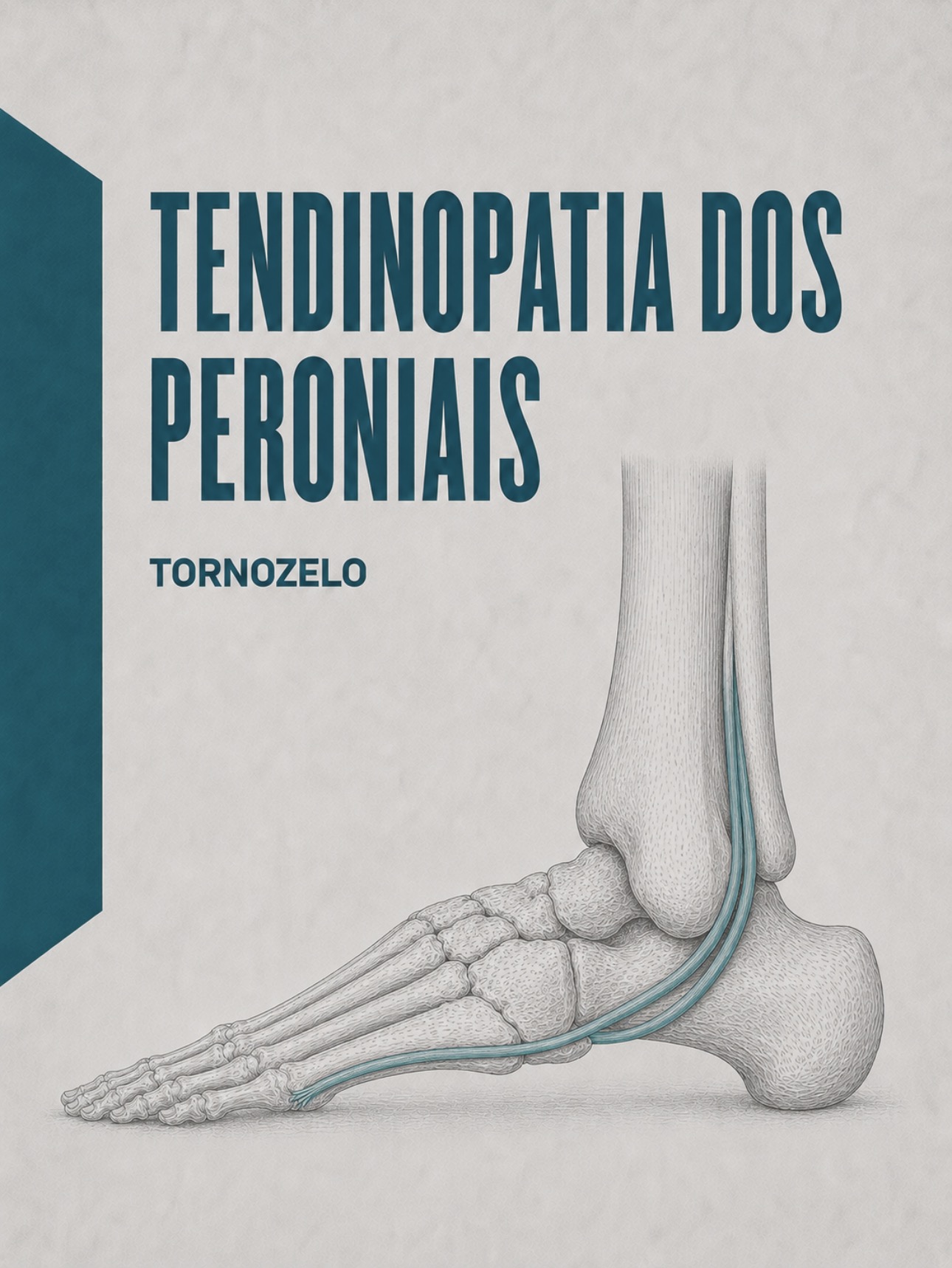 Ilustração médica dos tendões curto e longo peroneais no retromaléolo lateral