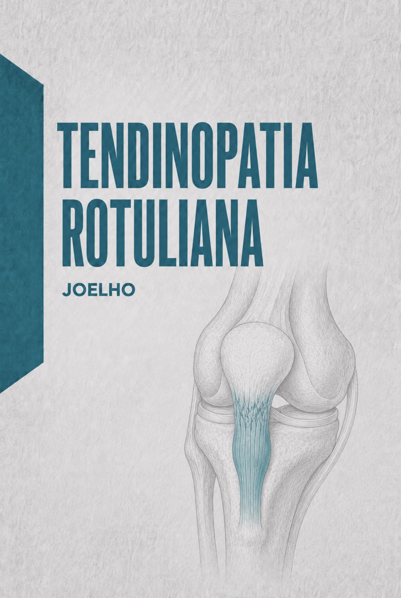 Ilustração médica do tendão rotuliano e polo inferior da rótula