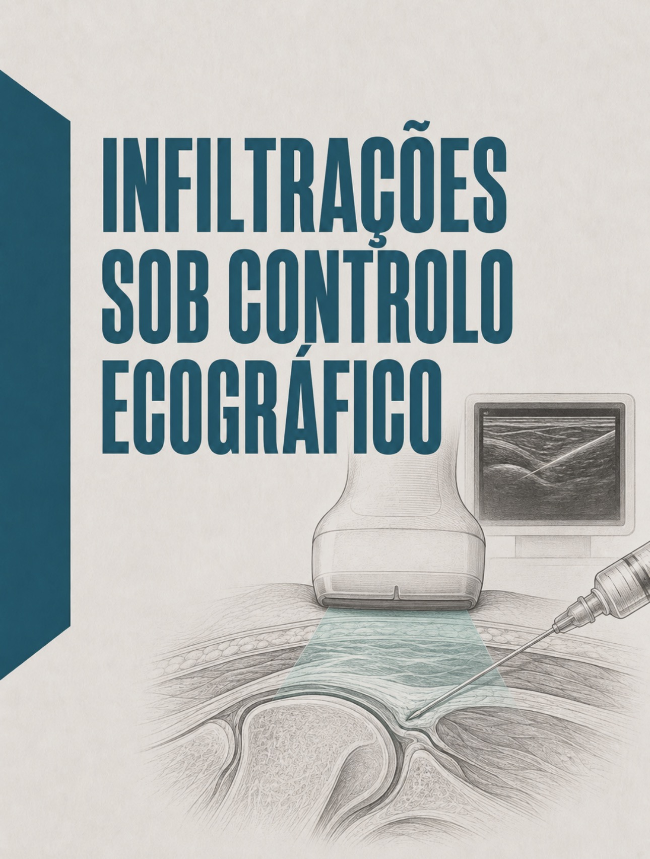 Ilustração clínica de procedimento de infiltração articular ou periarticular sob visualização ecográfica
